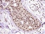 HSP27 Antibody in Immunohistochemistry (Paraffin) (IHC (P))