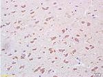 PEDF Antibody in Immunohistochemistry (Paraffin) (IHC (P))