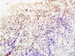 Livin Antibody in Immunohistochemistry (Paraffin) (IHC (P))