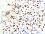 CDKN1A Antibody in Immunohistochemistry (Paraffin) (IHC (P))