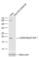 CDKN1B Antibody in Western Blot (WB)