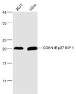 CDKN1B Antibody in Western Blot (WB)