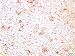 CTGF Antibody in Immunohistochemistry (Paraffin) (IHC (P))