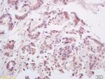 RANKL Antibody in Immunohistochemistry (Paraffin) (IHC (P))