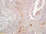 HLA G Antibody in Immunohistochemistry (Paraffin) (IHC (P))