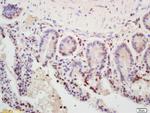 MSH2 Antibody in Immunohistochemistry (Paraffin) (IHC (P))