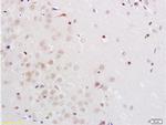 Midnolin Antibody in Immunohistochemistry (Paraffin) (IHC (P))