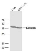 Midnolin Antibody in Western Blot (WB)