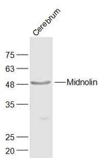 Midnolin Antibody in Western Blot (WB)