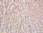 Phospho-FSCN1 (Ser39) Antibody in Immunohistochemistry (Paraffin) (IHC (P))