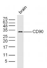 Thy1 Antibody in Western Blot (WB)