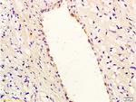IL-8 Antibody in Immunohistochemistry (Paraffin) (IHC (P))
