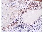 IL-6 Antibody in Immunohistochemistry (Paraffin) (IHC (P))