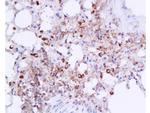 IL-6 Antibody in Immunohistochemistry (Paraffin) (IHC (P))