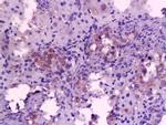 IL-6 Antibody in Immunohistochemistry (Paraffin) (IHC (P))
