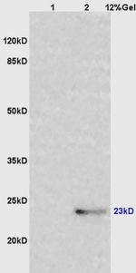 IL-6 Antibody in Western Blot (WB)