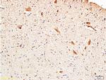 Fascin1 Antibody in Immunohistochemistry (Paraffin) (IHC (P))