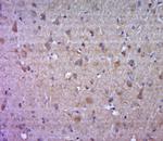 Fascin1 Antibody in Immunohistochemistry (Paraffin) (IHC (P))