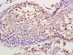 ACVR2A + ACVR2B Antibody in Immunohistochemistry (Paraffin) (IHC (P))