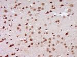 BRCA1 Antibody in Immunohistochemistry (Paraffin) (IHC (P))