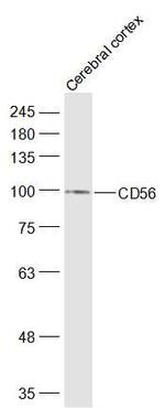 CD56 Antibody in Western Blot (WB)