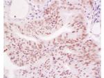 MLH1 Antibody in Immunohistochemistry (Paraffin) (IHC (P))