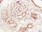 VE Cadherin Antibody in Immunohistochemistry (Paraffin) (IHC (P))