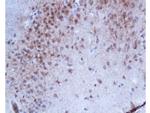 Phospho-ESR1 (Ser167) Antibody in Immunohistochemistry (Paraffin) (IHC (P))