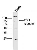 FSH receptor Antibody in Western Blot (WB)