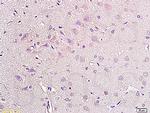 NPY2R Antibody in Immunohistochemistry (Paraffin) (IHC (P))
