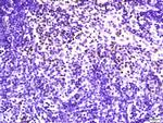 NKG2D Antibody in Immunohistochemistry (Paraffin) (IHC (P))