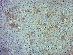 ADRB2 Antibody in Immunohistochemistry (Paraffin) (IHC (P))