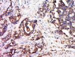 Collagen 3 Antibody in Immunohistochemistry (Paraffin) (IHC (P))