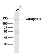 Collagen 3 Antibody in Western Blot (WB)