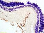 MTNR1B Antibody in Immunohistochemistry (Paraffin) (IHC (P))