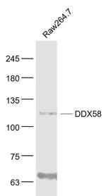 DDX58 Antibody in Western Blot (WB)