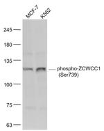 Phospho-ZCWCC1 (Ser739) Antibody in Western Blot (WB)