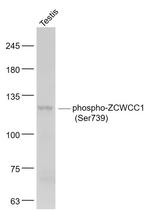 Phospho-ZCWCC1 (Ser739) Antibody in Western Blot (WB)