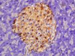 HADHSC Antibody in Immunohistochemistry (Paraffin) (IHC (P))