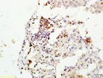 MGMT Antibody in Immunohistochemistry (Paraffin) (IHC (P))