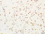 MGMT Antibody in Immunohistochemistry (Paraffin) (IHC (P))