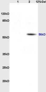 EAAT1 Antibody in Western Blot (WB)
