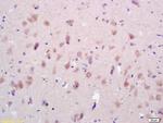 GluR1, GluR2 Antibody in Immunohistochemistry (Paraffin) (IHC (P))