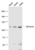 EPHA10 Antibody in Western Blot (WB)