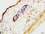 CK2 Antibody in Immunohistochemistry (Paraffin) (IHC (P))