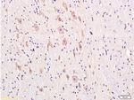 DRD1 Antibody in Immunohistochemistry (Paraffin) (IHC (P))