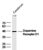DRD1 Antibody in Western Blot (WB)