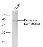 DRD2 Antibody in Western Blot (WB)