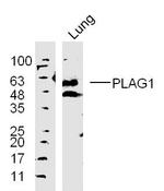 PLAG1 Antibody in Western Blot (WB)