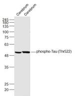 Phospho-Tau protein (Thr522) Antibody in Western Blot (WB)